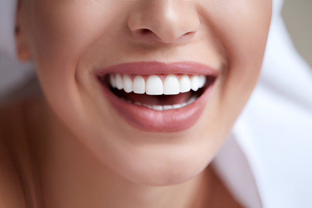 dental crowns near you in coral springs