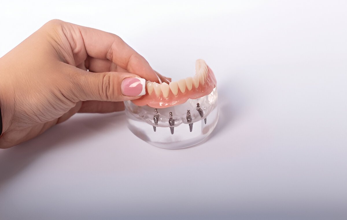 Dentures in Coral Springs