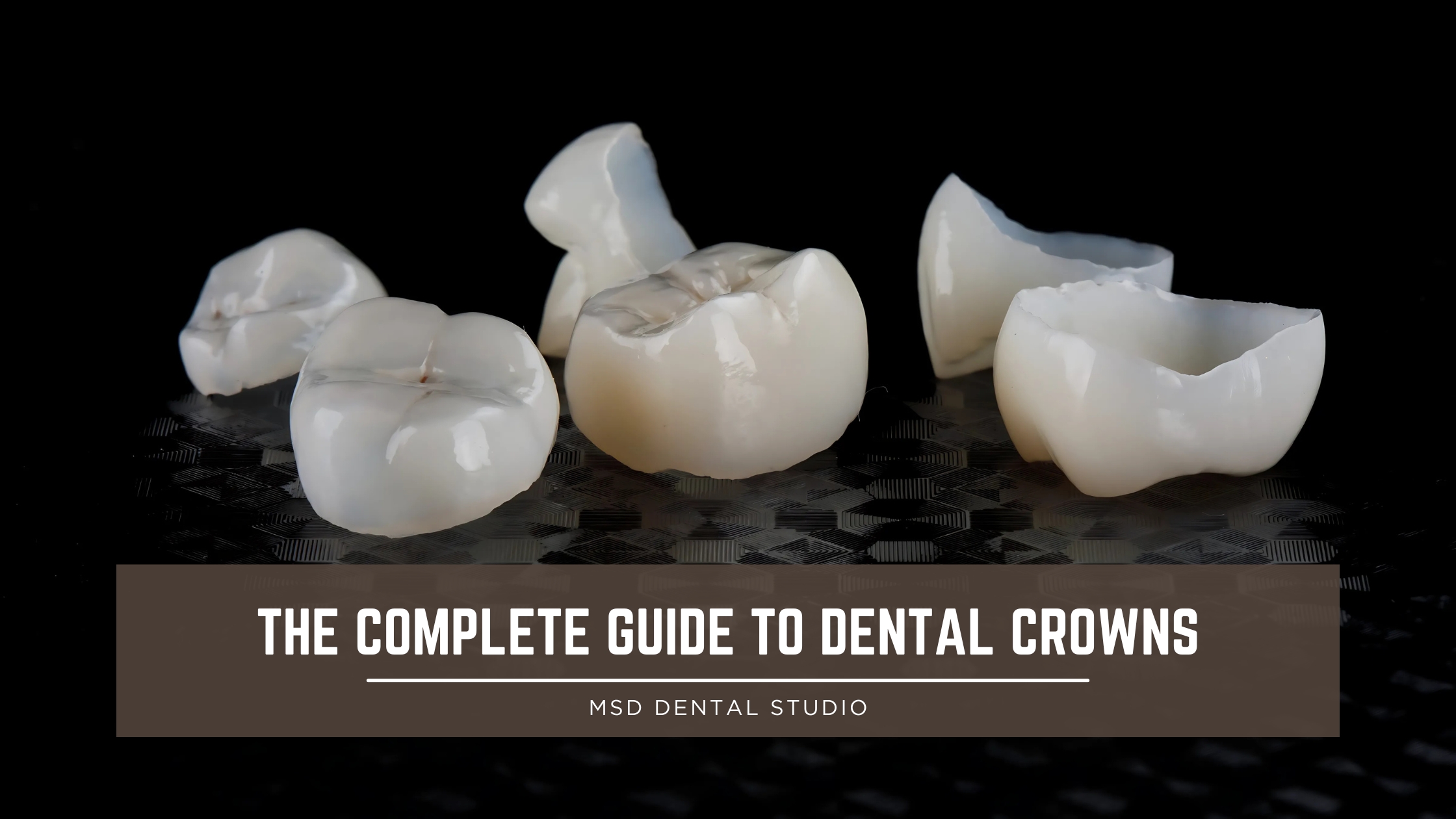 The Complete Guide to Dental Crowns: Types, Procedures, and Benefits